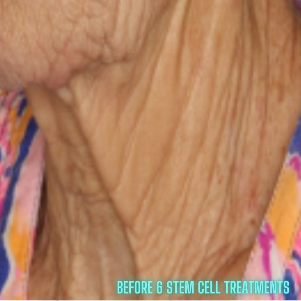 image of before a stem cell facial