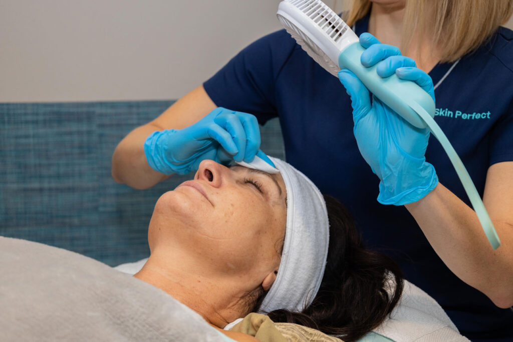 skin services peels - replenix perfect 10 peel