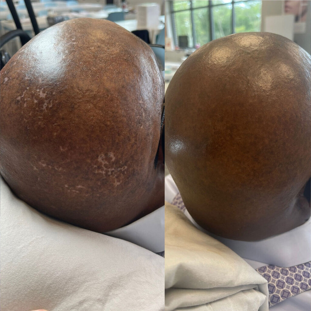 beauty services permanent makeup - body