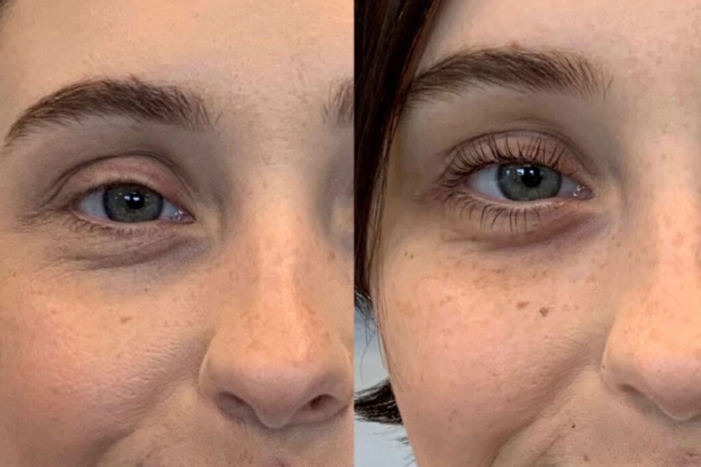 beauty services brows & lashes - lifting